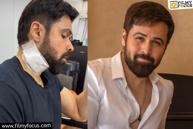 Emraan Hashmi Has Been Injured On The Sets